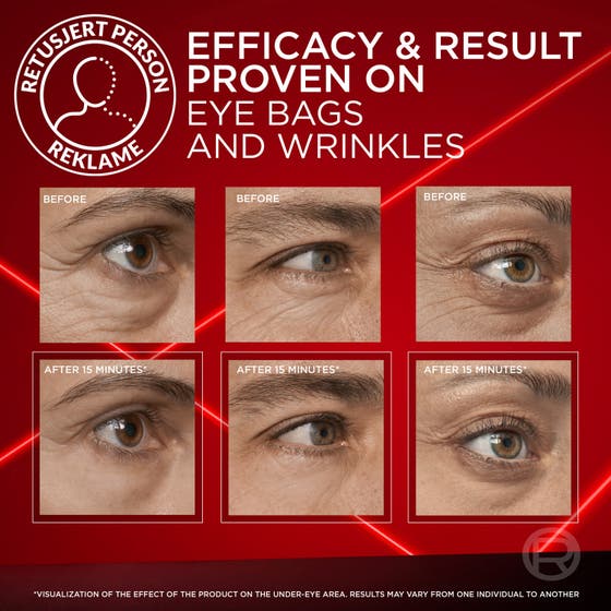 Revitalift Laser Eye Bag Eraser