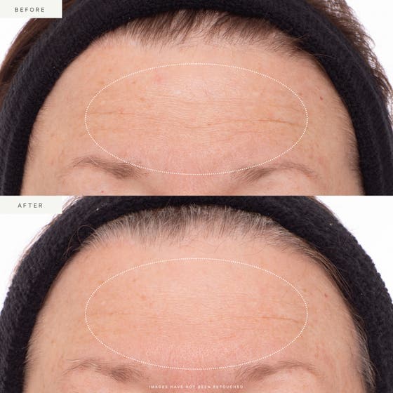 Plant Stem Cell Retinol Alternative Serum