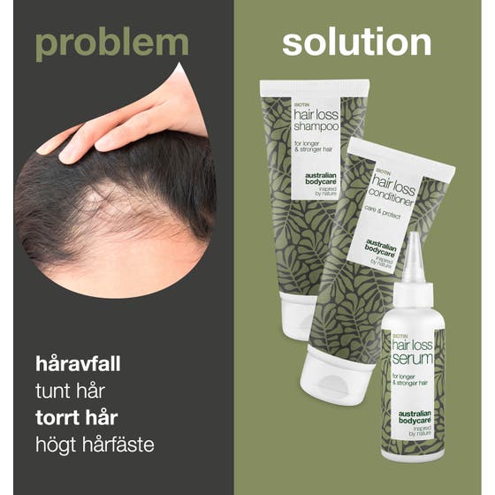 3 hair loss products