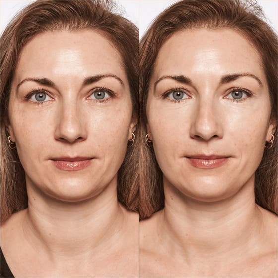 Eye Perfecting Set