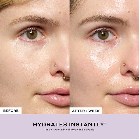 Strength Aprés-Skin Rich Rescue Treatment