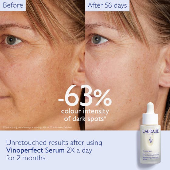 Vinoperfect Radiance Serum Complexion Correcting