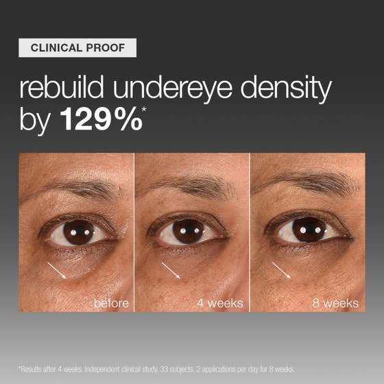 Smart Eye Density