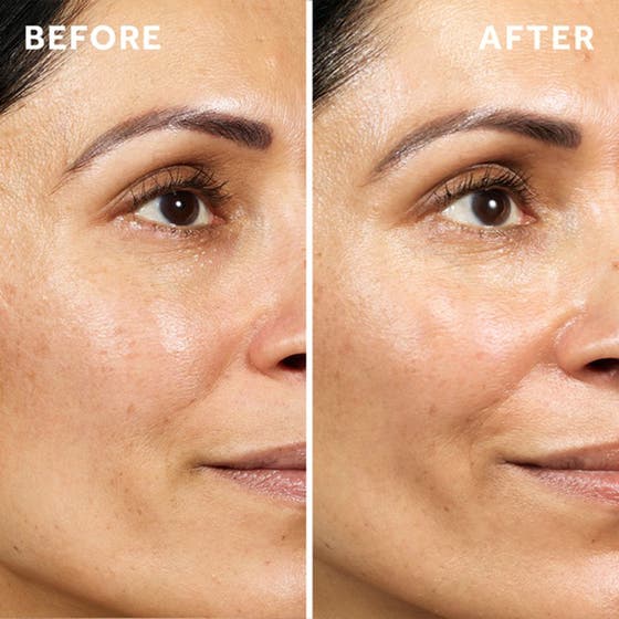 Pure Retinol Triple Action Day Cream