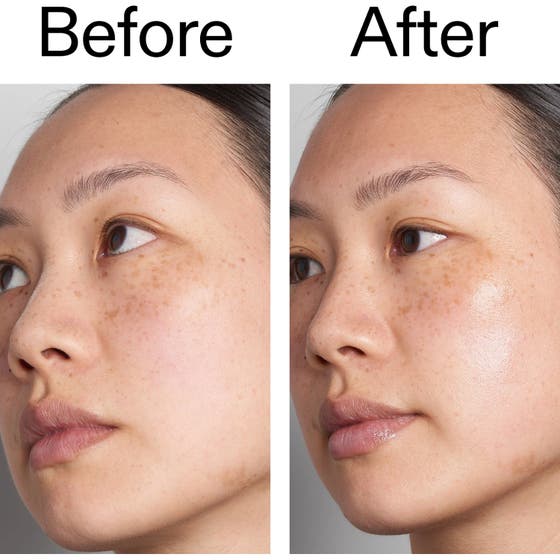 Hyaluronic Acid Serum