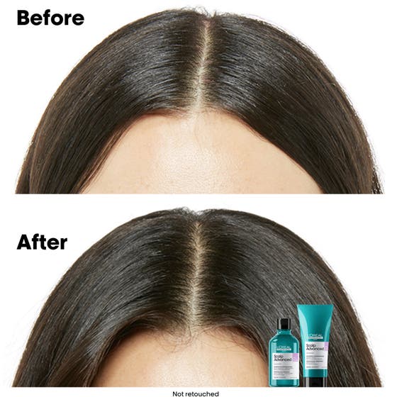 Scalp Advanced Anti-Discomfort Shampoo