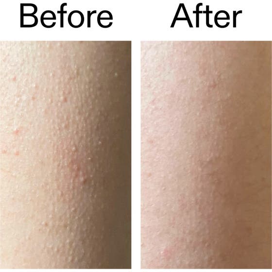 Glycolic Acid Exfoliating Body Stick